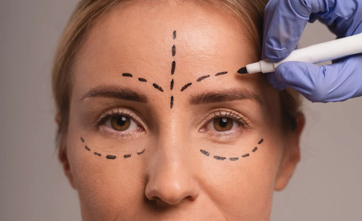 Best Skin & Laser Treatment in Chhattisgarh